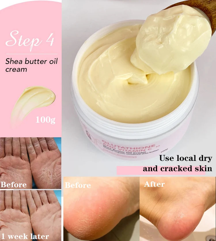 Crème de soin éclaircissante pour la peau AILKE, lotion éclaircissante, élimine les taches foncées avec glutathion, beurre de karité, crème corporelle hydratante