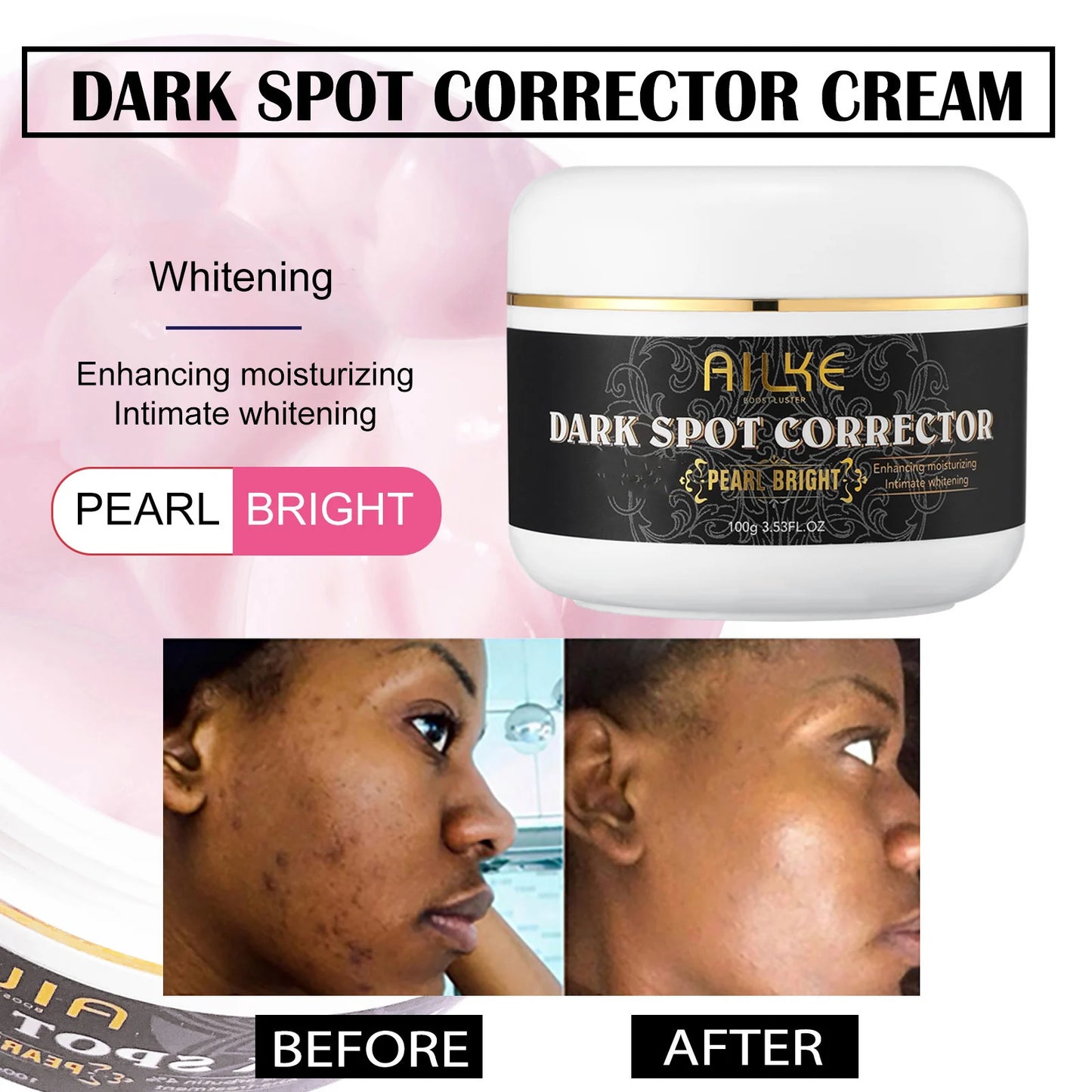 Ensemble de soins de la peau au collagène AILKE pour femmes, hydratant, blanchissant, élimine les taches de rousseur, les taches brunes, les points noirs, kit éclaircissant pour la peau