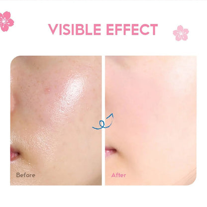 Crème essence Sakura du Japon, crème illuminatrice Sakura avec acide hyaluronique,